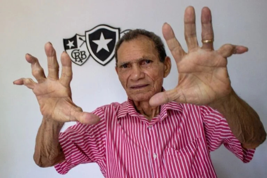 Manga, goleiro lendário do Botafogo e da seleção, morre no Rio